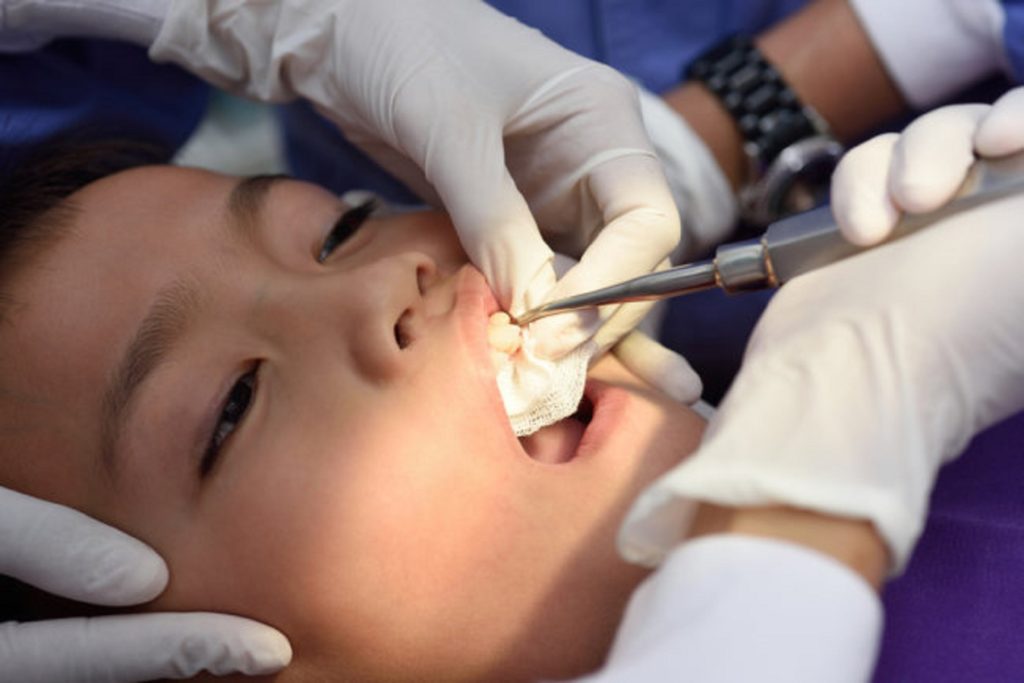 Cara Mengobati Sakit Gigi pada Anak