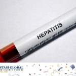 Kenali Gejala Hepatitis Misterius yang Mewabah di Dunia