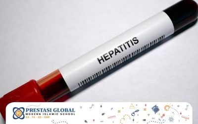 Kenali Gejala Hepatitis Misterius yang Mewabah di Dunia